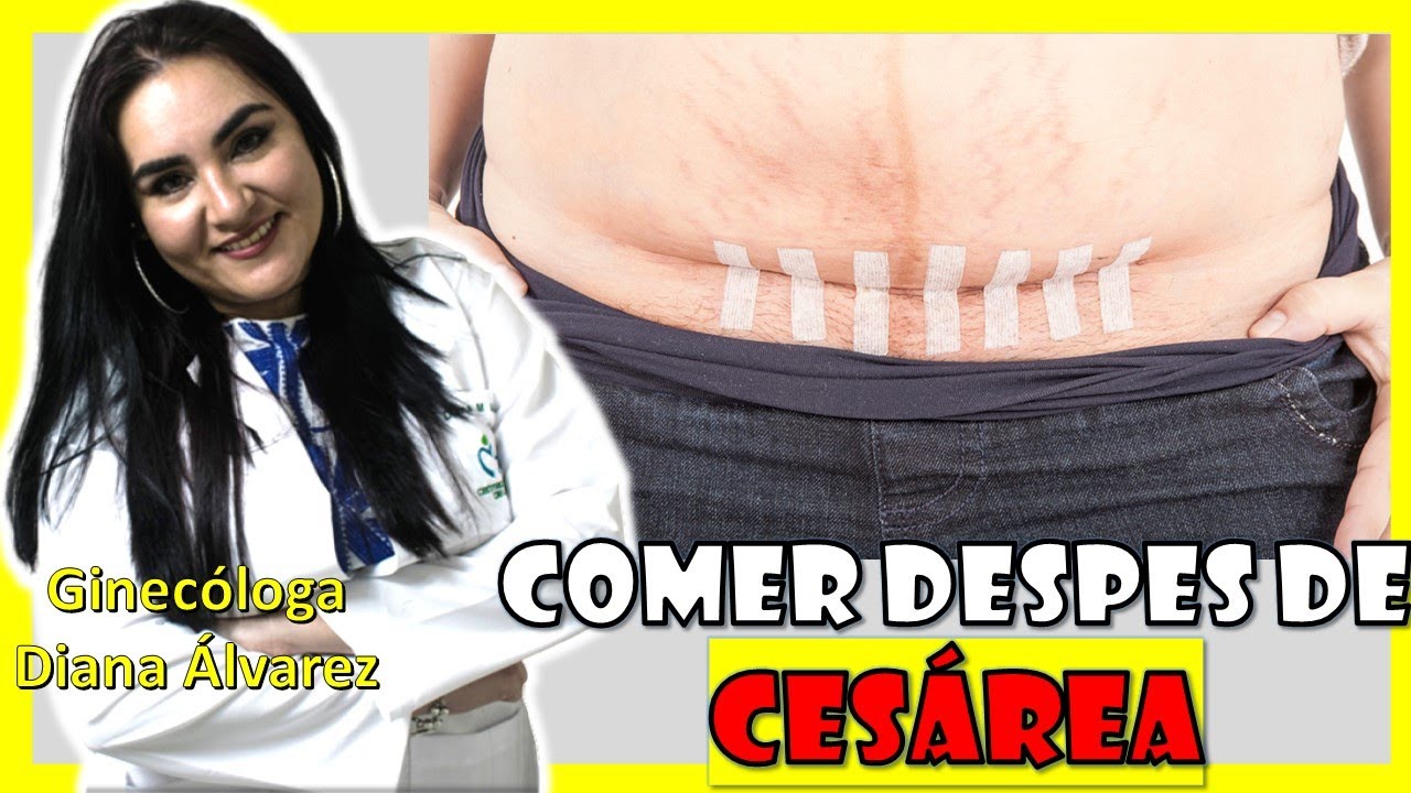 Consejos de comida saludable para mujeres después de una cesárea