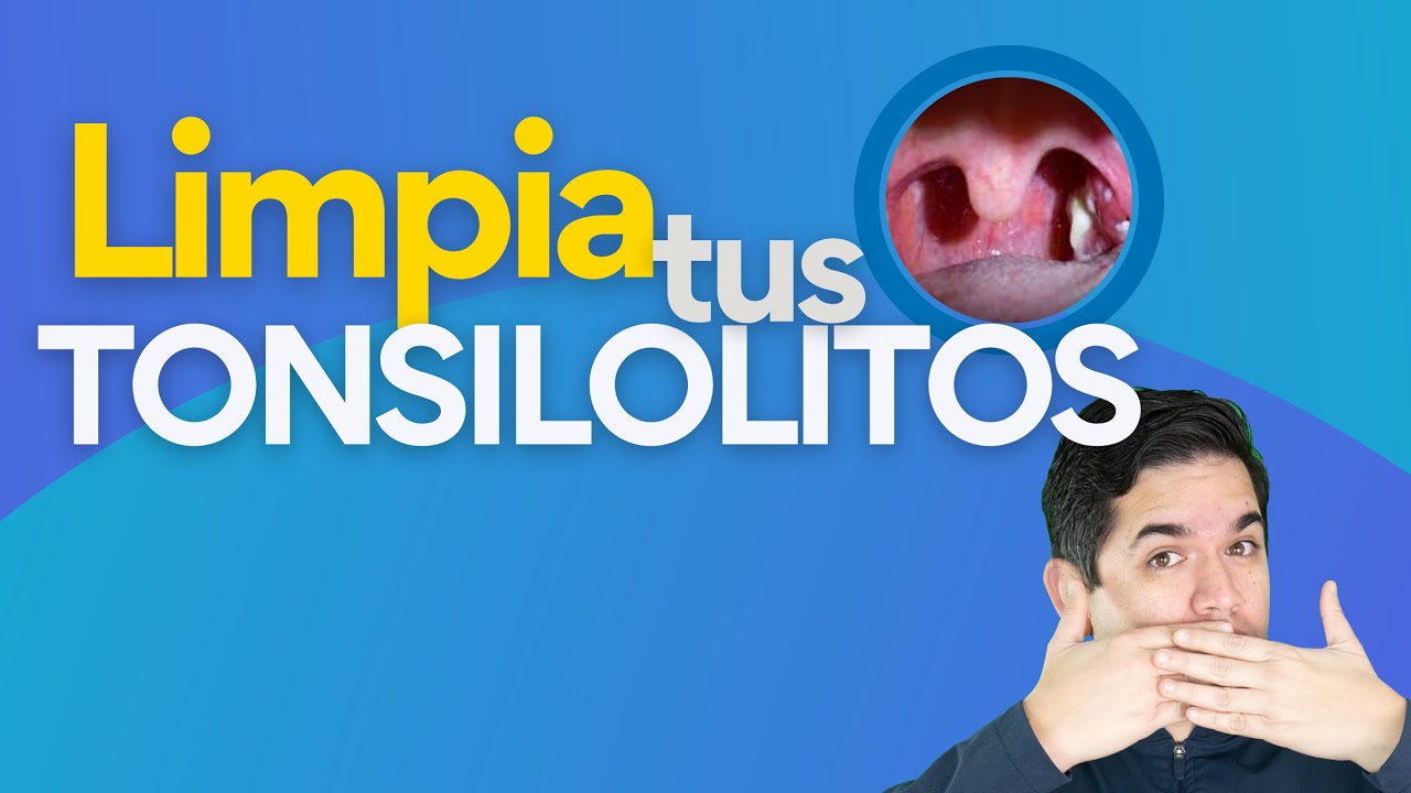 Consejos para eliminar los restos de comida en las amígdalas