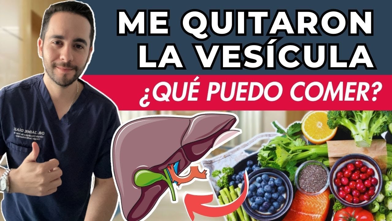 Cuida tu salud digestiva sin vesícula