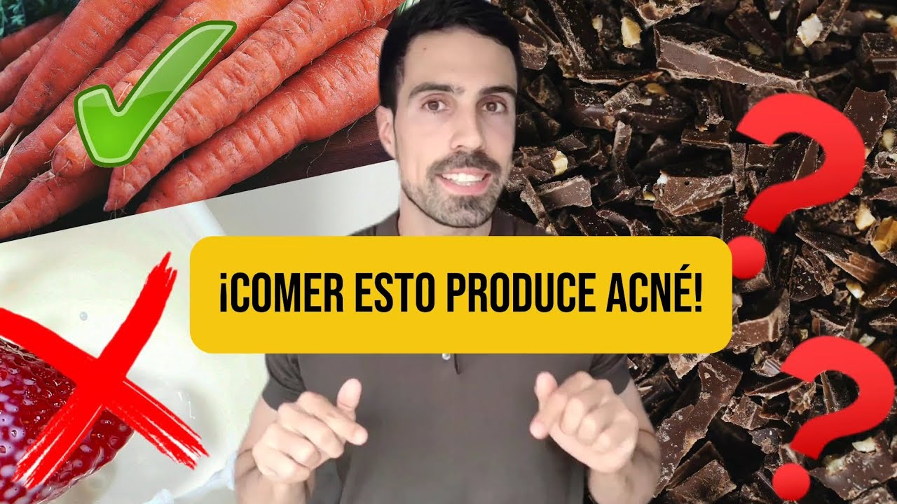 Evita alimentos para prevenir granos en la piel