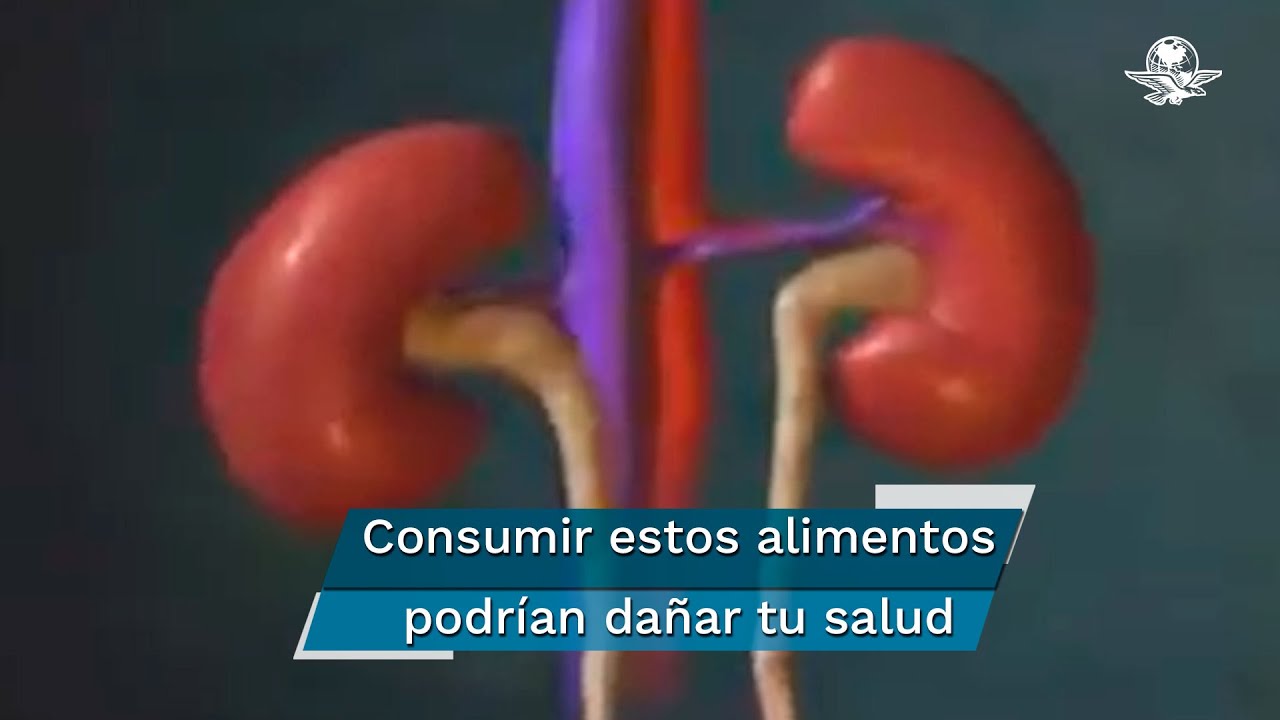 Los alimentos que debes evitar para cuidar tus riñones