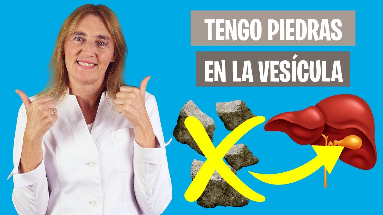 Consejos de comida para prevenir cálculos en la vesícula