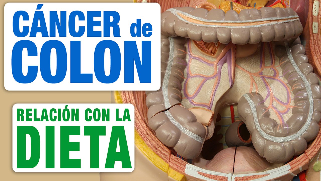 Alimentos contra cáncer de colon: importancia de una buena comida
