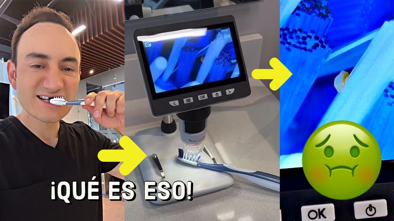 Cómo eliminar los restos de comida en los dientes de manera efectiva
